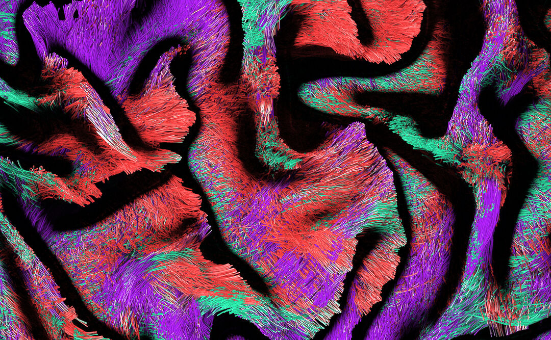 Fiber tractography delineating the white matter of the brain. Copyright: Lucius Fekonja, adapted by NODE Berlin Oslo.
